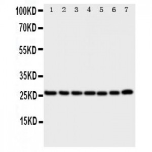 SIAH Interacting Protein Antibody