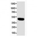 SKP2 Antibody