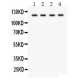 SLC12A1  Antibody