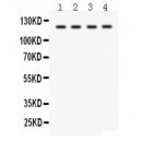 SLC12A1  Antibody