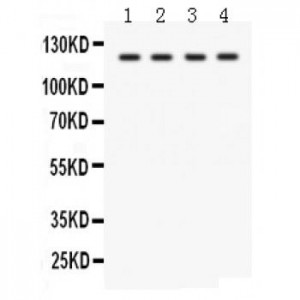 SLC12A1  Antibody