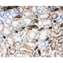 SLC12A1 Antibody