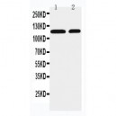 SLC12A3 Antibody