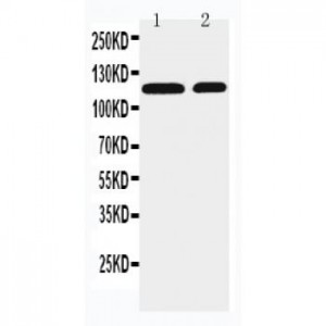 SLC12A3 Antibody