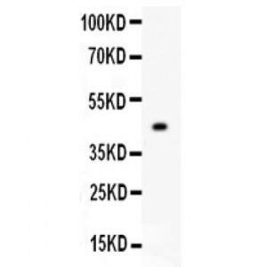 SLC16A3  Antibody