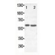 SLC22A6 Antibody