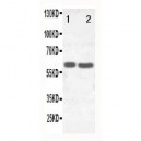 SLC22A6 Antibody