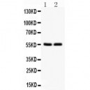 SLC2A1  Antibody