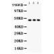 SLC2A2  Antibody