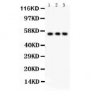 SLC2A2  Antibody