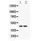 SLC30A4 Antibody