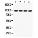 SLC6A4  Antibody