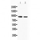 SLC9A2 Antibody