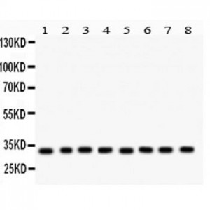 SMN1/2  Antibody