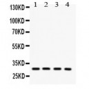 SNRPN  Antibody