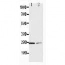 SOCS1 Antibody