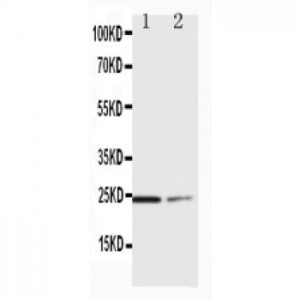 SOCS1 Antibody