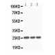 SOCS3 Antibody