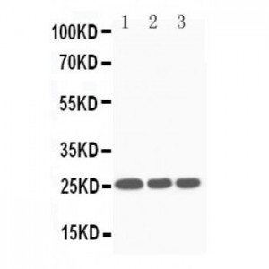 SOCS3 Antibody