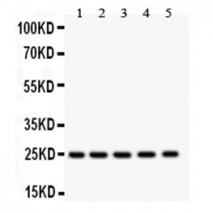 SOD2  Antibody