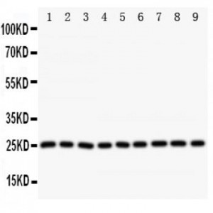 SOD2 Antibody