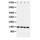 Somatostatin Antibody