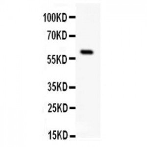 Somatostatin Receptor 1 Antibody