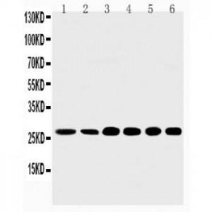 Sonic Hedgehog Antibody