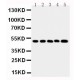 SPHK1 Antibody