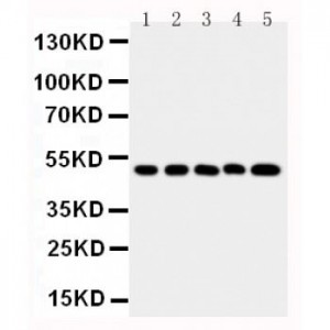 SPHK1 Antibody