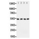 SPTLC1 Antibody