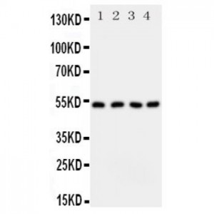 SPTLC1 Antibody