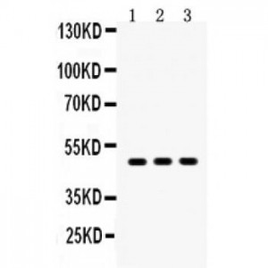 SQSTM1/p62  Antibody