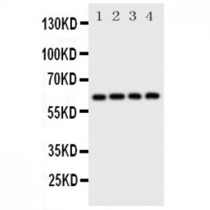 SQSTM1/p62 Antibody