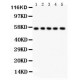 SSH3BP1  Antibody