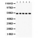 SSH3BP1  Antibody