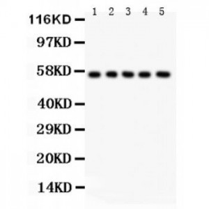 SSH3BP1  Antibody