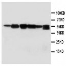 SSH3BP1 Antibody