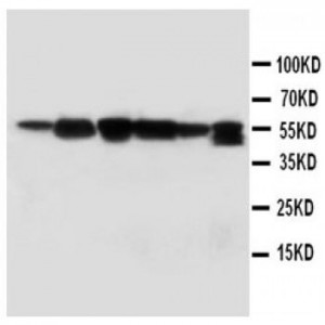 SSH3BP1 Antibody