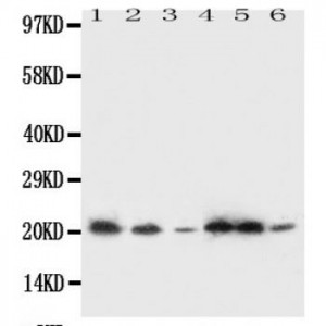 SSR3 Antibody