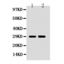 SSX2 Antibody