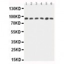 STAT5b Antibody