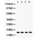 Stathmin 1  Antibody