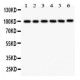 STIM1  Antibody