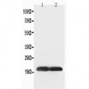 Superoxide Dismutase 1 Antibody