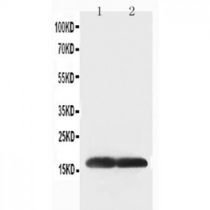 Superoxide Dismutase 1 Antibody