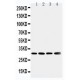 Superoxide Dismutase 3 Antibody