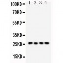 Surfactant Protein A Antibody