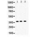 Surfactant protein D  Antibody