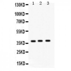 Surfactant protein D  Antibody